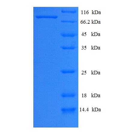 Protein SDS-PAGE