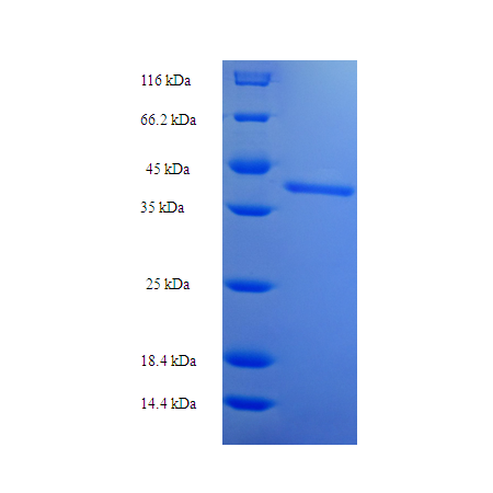 Protein SDS-PAGE
