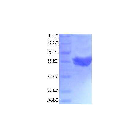 Protein SDS-PAGE