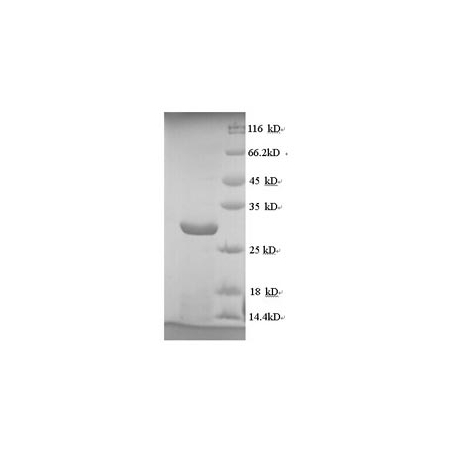 SDS-PAGE- Recombinant protein HHV-5 GL