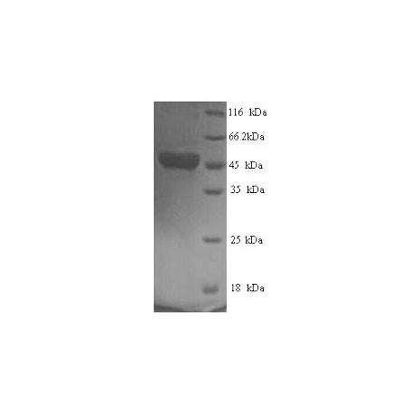 SDS-PAGE- Recombinant protein Human respiratory syncytial virus B F