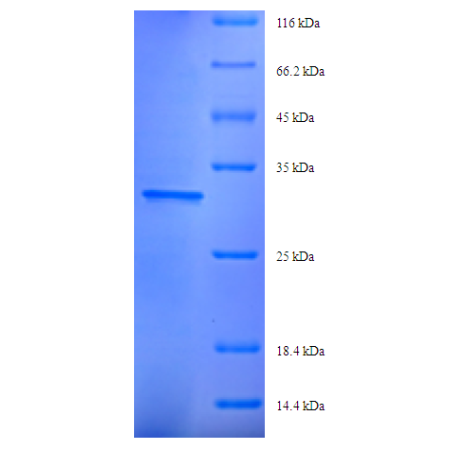Protein SDS-PAGE