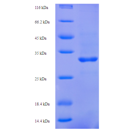 Protein SDS-PAGE