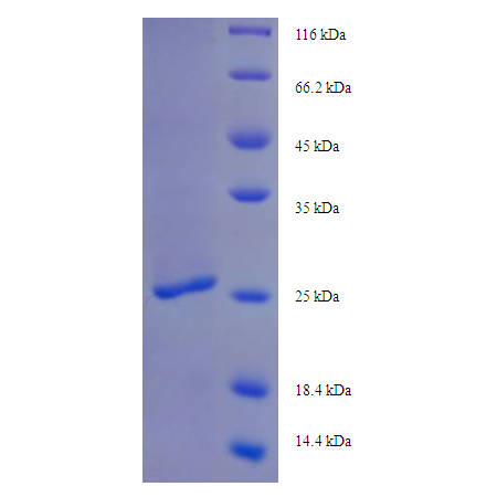 Protein SDS-PAGE