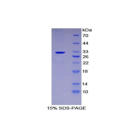 SDS-PAGE