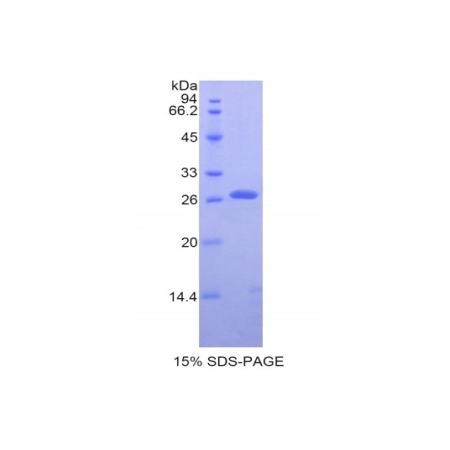 SDS-PAGE