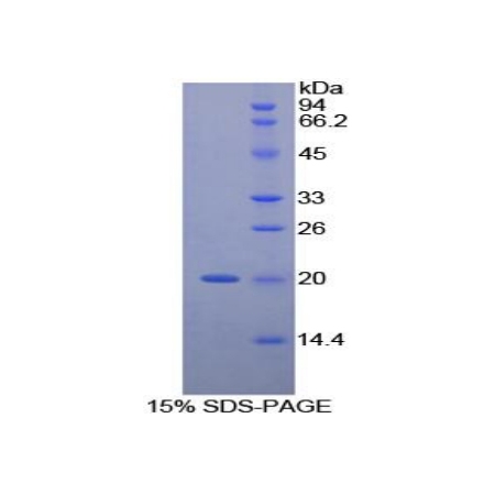 SDS-PAGE