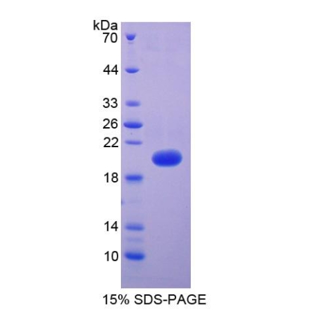 SDS-PAGE