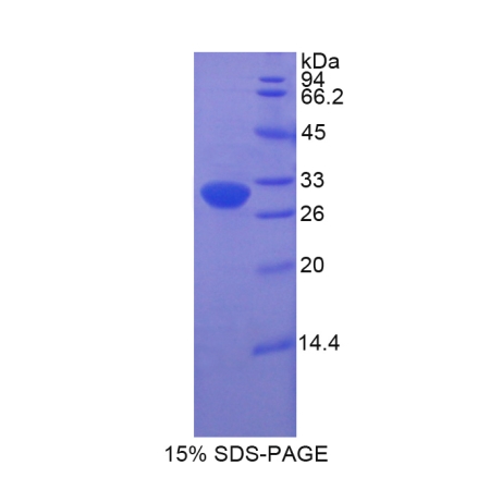 SDS-PAGE