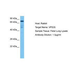 Human Fetal Lung