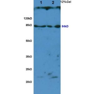 L1 rat brain, L2 rat lung lysates