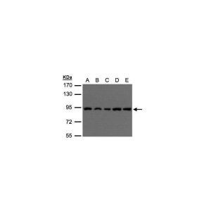 H1299, HeLa S3, HepG2, MOLT4, Raji 
