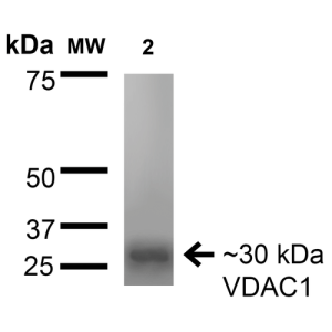 Western Blot
