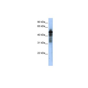 Transfected 293T
