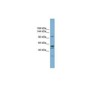 Human OVCAR-3