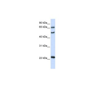 Human 293T