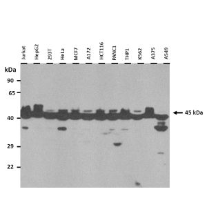 Western Blot
