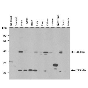 Western Blot