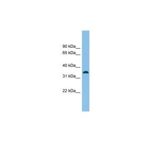 Human HCT15