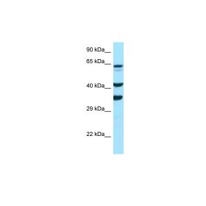 Human PANC1