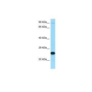 Human OVCAR-3
