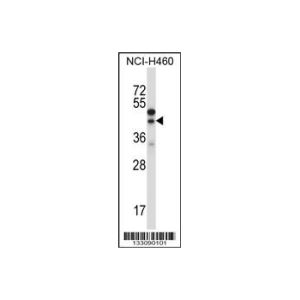 NCI-H460