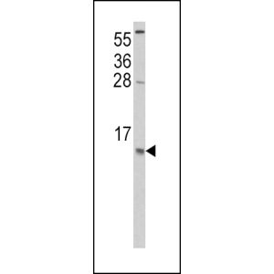 Hela cell