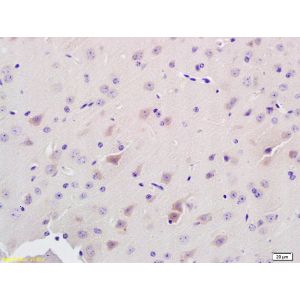 Rat brain