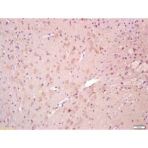 Rat brain