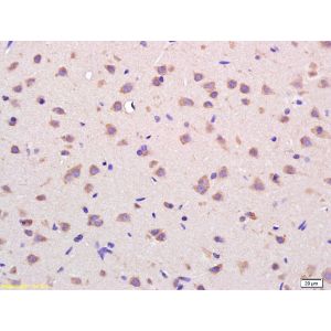 Rat brain