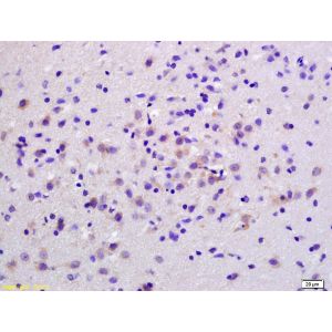 Rat brain