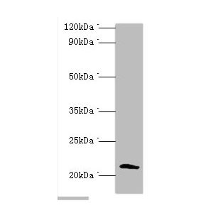 MDA-MB-231 whole cell lysate