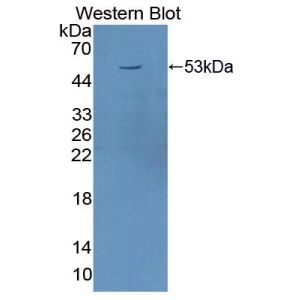 Transferrin receptor protein 1