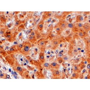 Human Liver