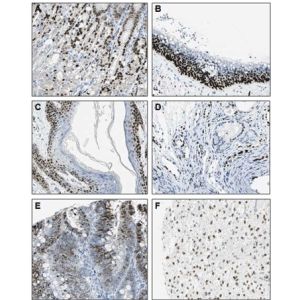 Different human normal tissues (A: Stomach; B: Bronchus; C: Vulva/Anal skin; D: Nasopharynx) or cancer tissues (E: Colorectal cancer; F: Malignant glioma)