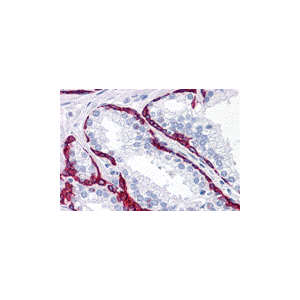 Prostate tissue
