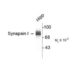 Rat hippocampal (Hipp)