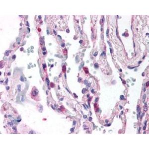 Human lung