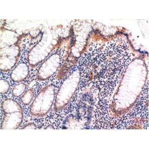 Immunohistochemistry