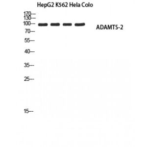 HepG2, K562, HeLa, Colo