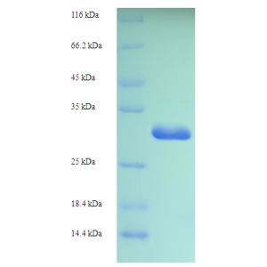 Protein SDS-PAGE