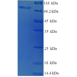 Protein SDS-PAGE