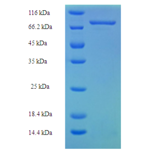 Protein SDS-PAGE