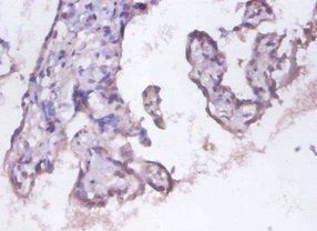 PSMD11 Antibody