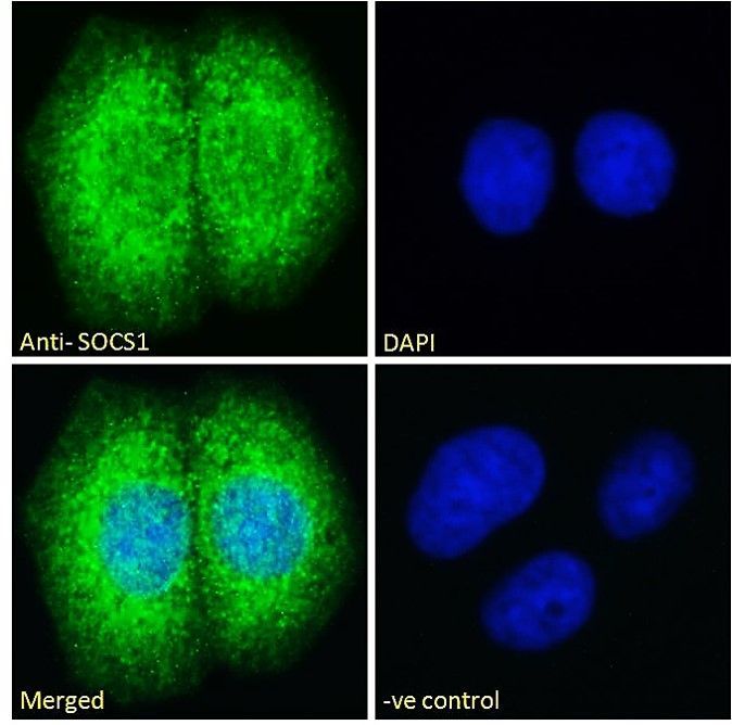 SOCS1 Antibody