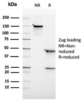 ALK Antibody