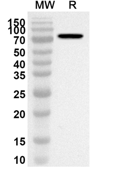 Bacteriophage T4 DNA ligase/30 Rabbit Polyclonal Antibody
