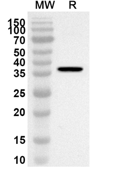 VLDLR Rabbit Polyclonal Antibody