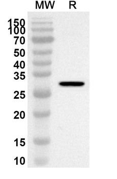 PYGB Rabbit Polyclonal Antibody