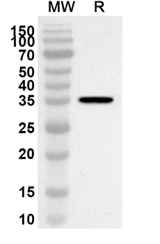 CD126/IL6R/IL-6RA Rabbit Polyclonal Antibody